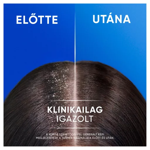 Head & Shoulders Menthol Fresh 2in1 korpásodás elleni sampon 400ml. Frissítő mentolillat