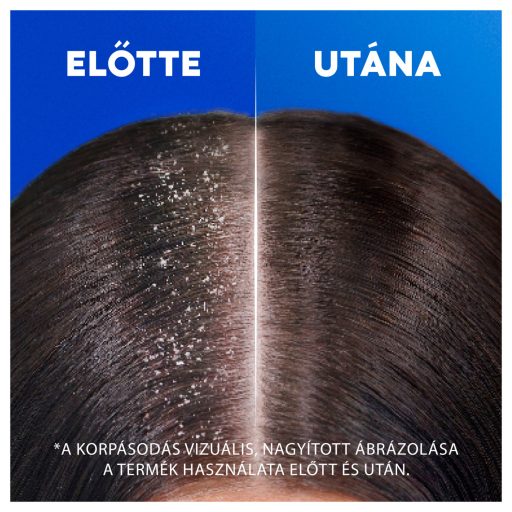 Head & Shoulders Classic Clean korpásodás elleni sampon 800ml pumpás, napi használatra