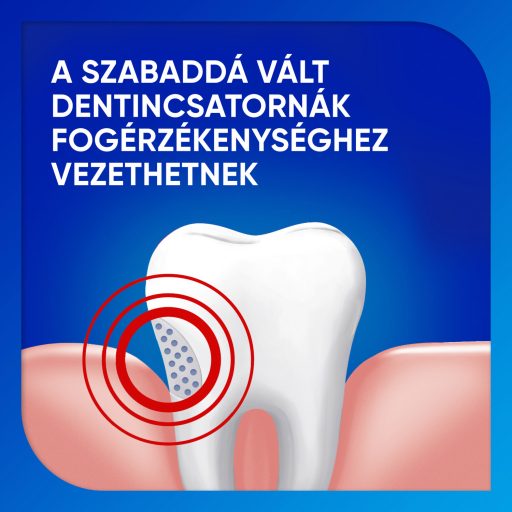 Sensodyne Extra Whitening fluoridos fogkrém 75 ml