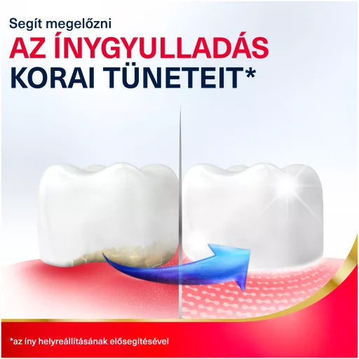 Parodontax Advanced Active Gum Repair Whitening fluoridos fogkrém 75 ml