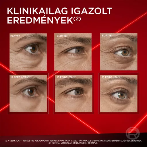 L'Oreal szemkörnyék ápoló krém 15ml szemek alatti táskákra Rev. L. nappali