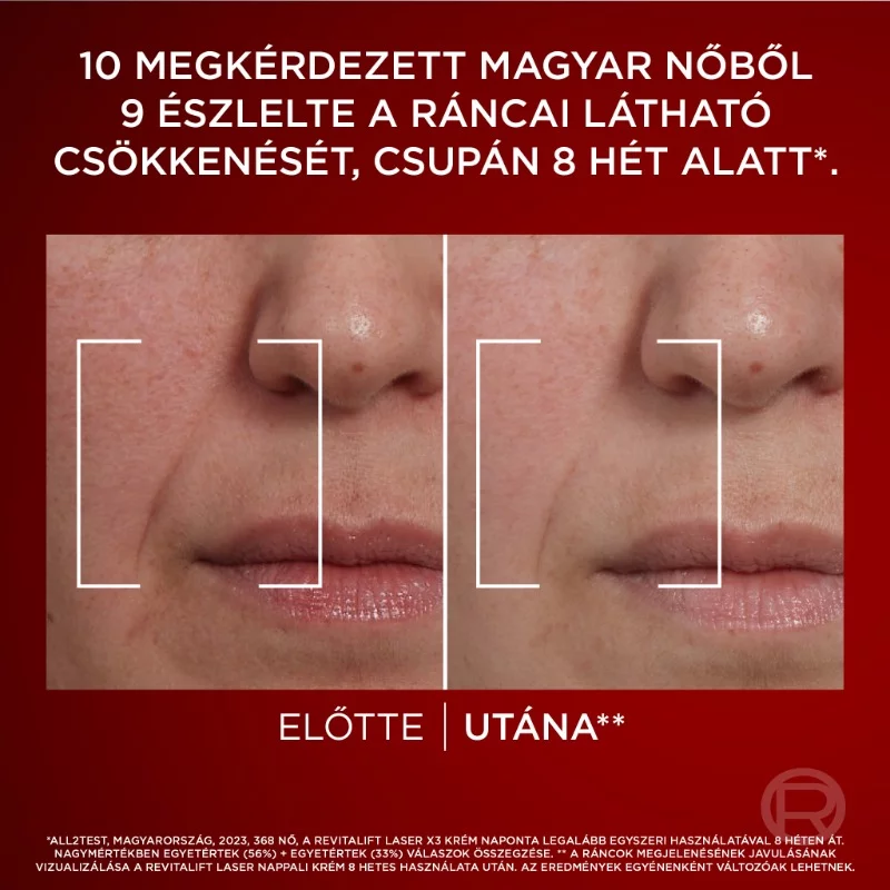 L´Oreal Revitalift X3 Laser arckrém 50+50ml nappali + éjszakai Duo