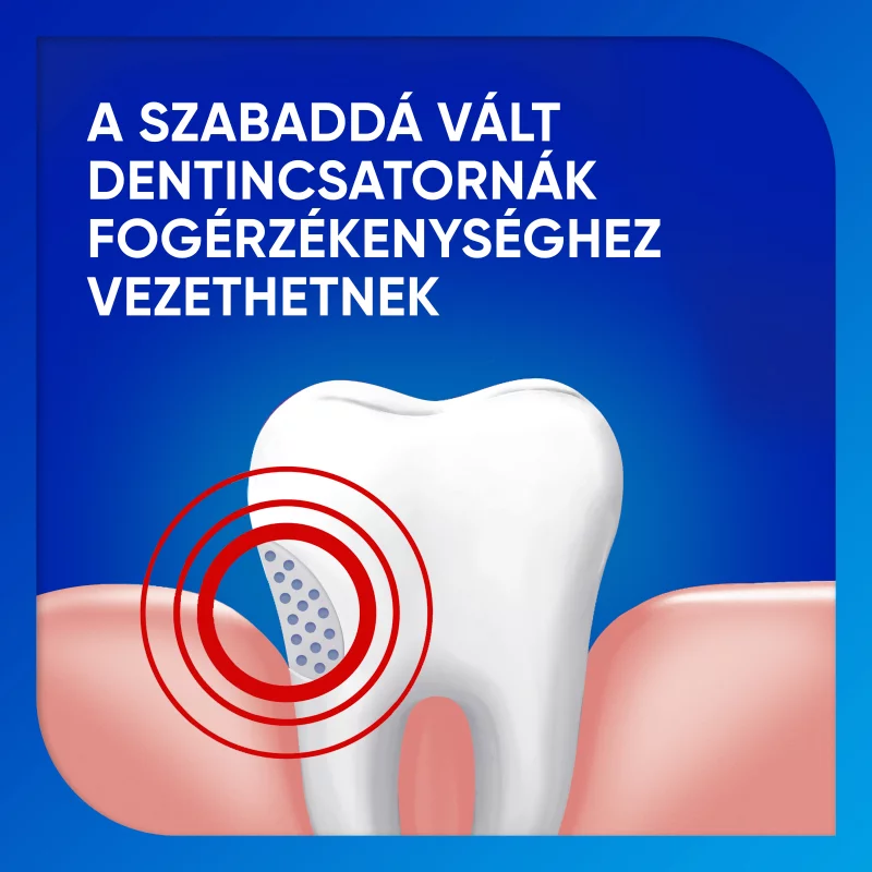 Sensodyne Extra Whitening fluoridos fogkrém 75 ml