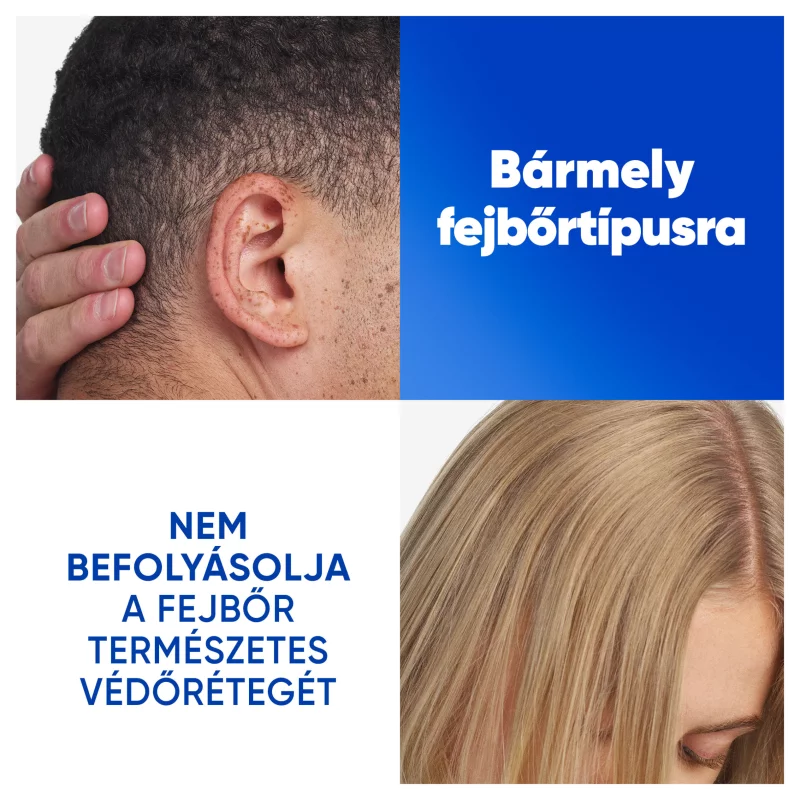 Head & Shoulders Deep Hydration korpa elleni sampon 400ml kókuszolajjal, napi használatra