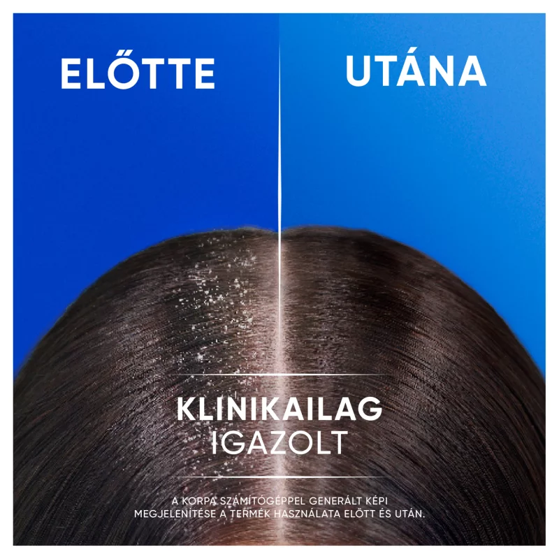 Head & Shoulders Classic Clean 2az1-ben korpásodás elleni sampon 330ml. Friss tiszta Illat