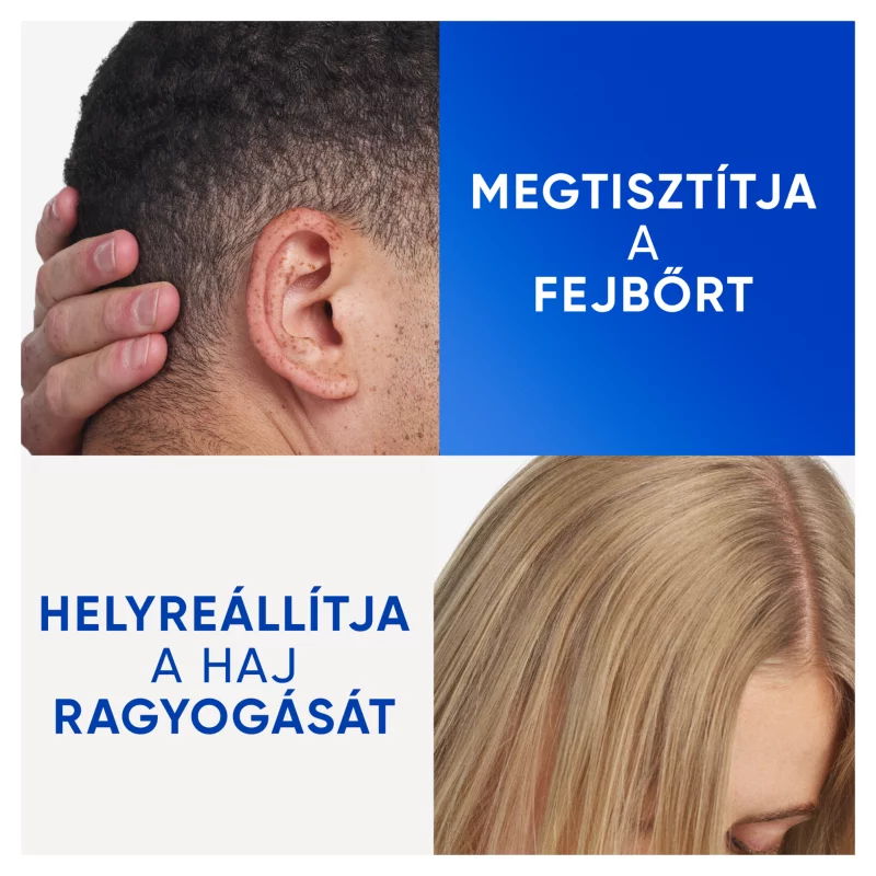 Head & Shoulders Clarify & Shine korpásodás elleni sampon 400ml. Almaecettel