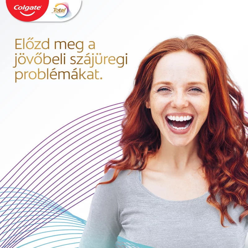 Colgate Total Whitening fogfehérítő fogkrém 75 ml